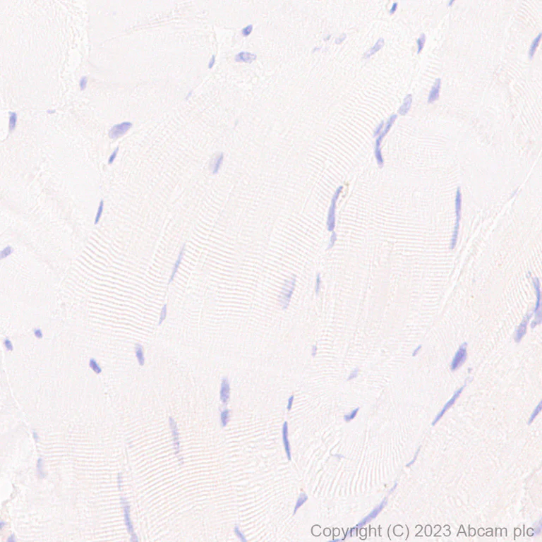 Immunohistochemistry (Formalin/PFA-fixed paraffin-embedded sections) - Anti-HLA-DOB antibody [DOB.L1] - BSA and Azide free (AB312859)