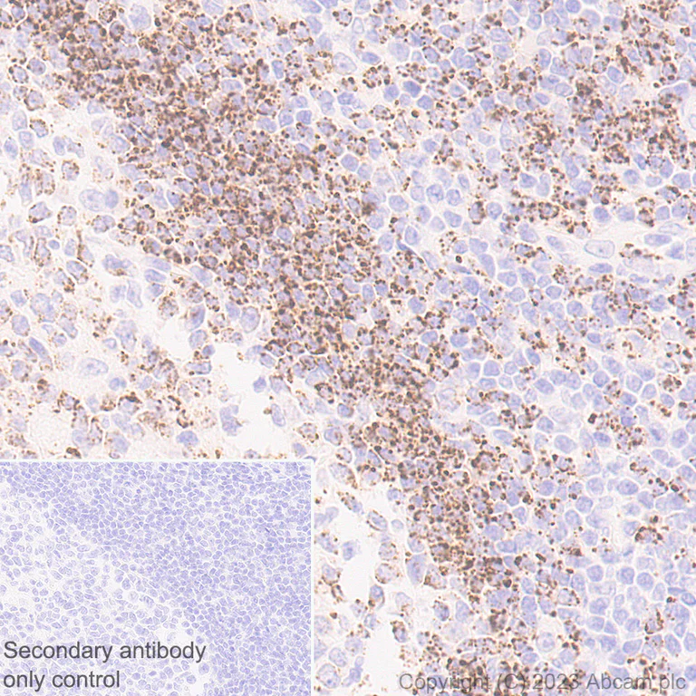 Immunohistochemistry (Formalin/PFA-fixed paraffin-embedded sections) - Anti-HLA-DOB antibody [DOB.L1] - BSA and Azide free (AB312859)