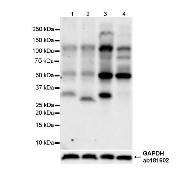 Western blot - Anti-HLA-DOB antibody [DOB.L1] - BSA and Azide free (AB312859)