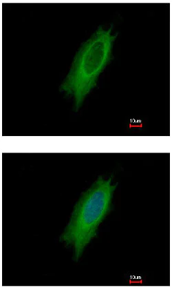 Immunocytochemistry/ Immunofluorescence - Anti-HLA-DP antibody (AB153886)
