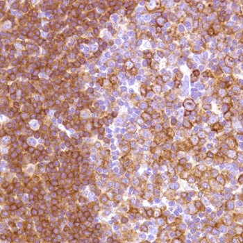 Immunohistochemistry (Formalin/PFA-fixed paraffin-embedded sections) - Anti-HLA-DP antibody [SP228] (AB227675)