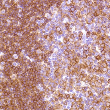 Immunohistochemistry (Formalin/PFA-fixed paraffin-embedded sections) - Anti-HLA-DP antibody [SP228] - BSA and Azide free (AB245736)
