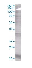 HLA-DP overexpression 293T lysate (whole cell)