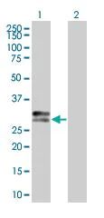 Western blot - HLA-DP overexpression 293T lysate (whole cell) (AB94190)