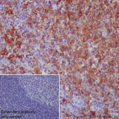 Anti-HLA-DPB1 antibody [EPR11226]