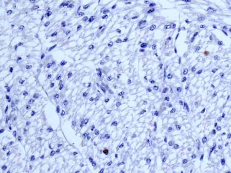 Immunohistochemistry (Formalin/PFA-fixed paraffin-embedded sections) - Anti-HLA-DPB1 antibody [EPR11226] (AB157210)