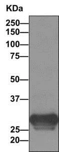 Western blot - Anti-HLA-DPB1 antibody [EPR11226] (AB157210)