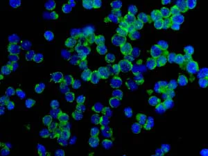 Immunocytochemistry/ Immunofluorescence - Anti-HLA-DPB1 antibody [EPR11226] - BSA and Azide free (AB215973)