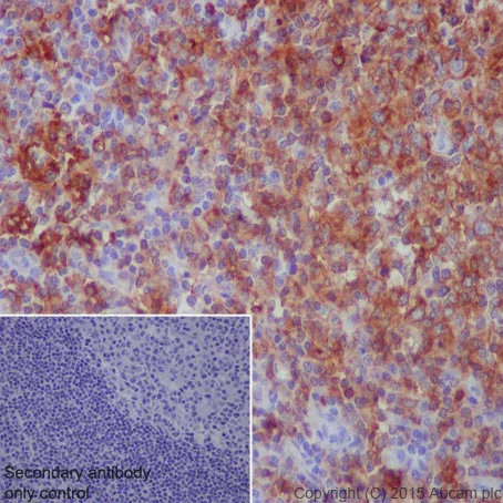 Immunohistochemistry (Formalin/PFA-fixed paraffin-embedded sections) - Anti-HLA-DPB1 antibody [EPR11226] - BSA and Azide free (AB215973)