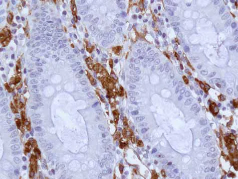 Immunohistochemistry (Formalin/PFA-fixed paraffin-embedded sections) - Anti-HLA-DPB1 antibody [EPR11226] - BSA and Azide free (AB215973)