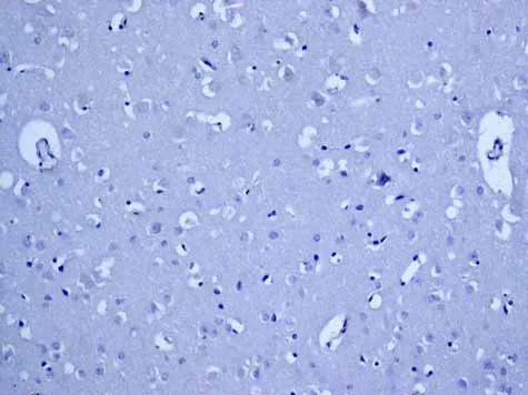 Immunohistochemistry (Formalin/PFA-fixed paraffin-embedded sections) - Anti-HLA-DPB1 antibody [EPR11226] - BSA and Azide free (AB215973)