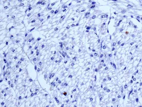 Immunohistochemistry (Formalin/PFA-fixed paraffin-embedded sections) - Anti-HLA-DPB1 antibody [EPR11226] - BSA and Azide free (AB215973)