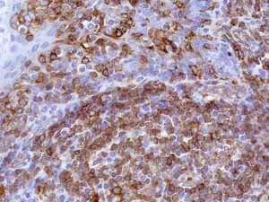 Immunohistochemistry (Formalin/PFA-fixed paraffin-embedded sections) - Anti-HLA-DPB1 antibody [EPR11226] - BSA and Azide free (AB215973)