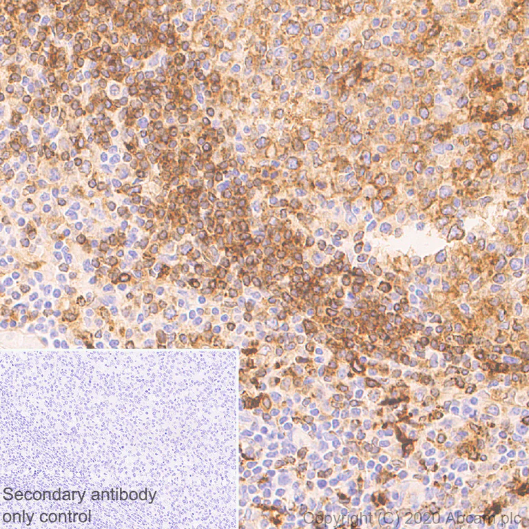 Immunohistochemistry (Formalin/PFA-fixed paraffin-embedded sections) - Anti-HLA-DPB1 antibody [EPR23947-1] - BSA and Azide free (AB278084)