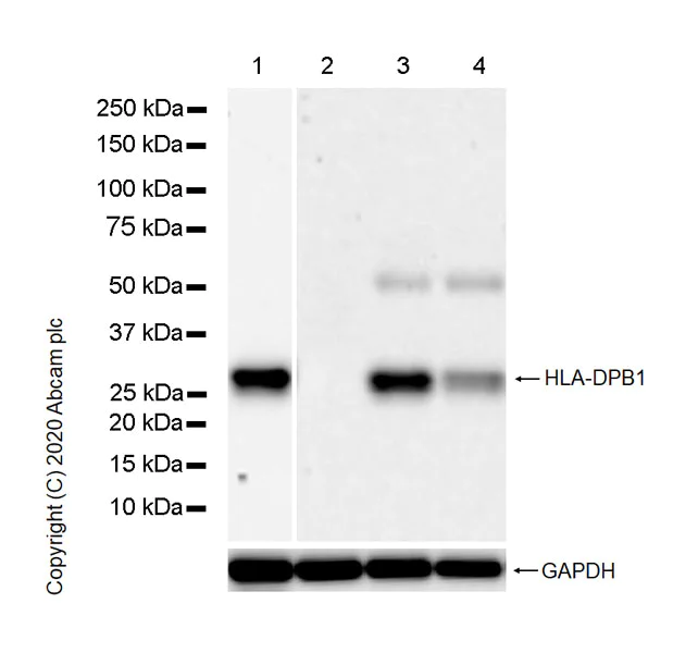 Western blot - Anti-HLA-DPB1 antibody [EPR23947-1] - BSA and Azide free (AB278084)