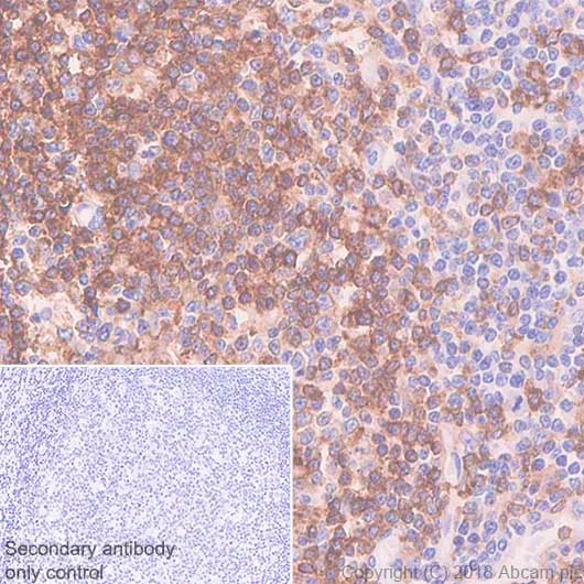 Immunohistochemistry (Formalin/PFA-fixed paraffin-embedded sections) - Anti-HLA-DPB1 antibody [SP229] (AB227676)