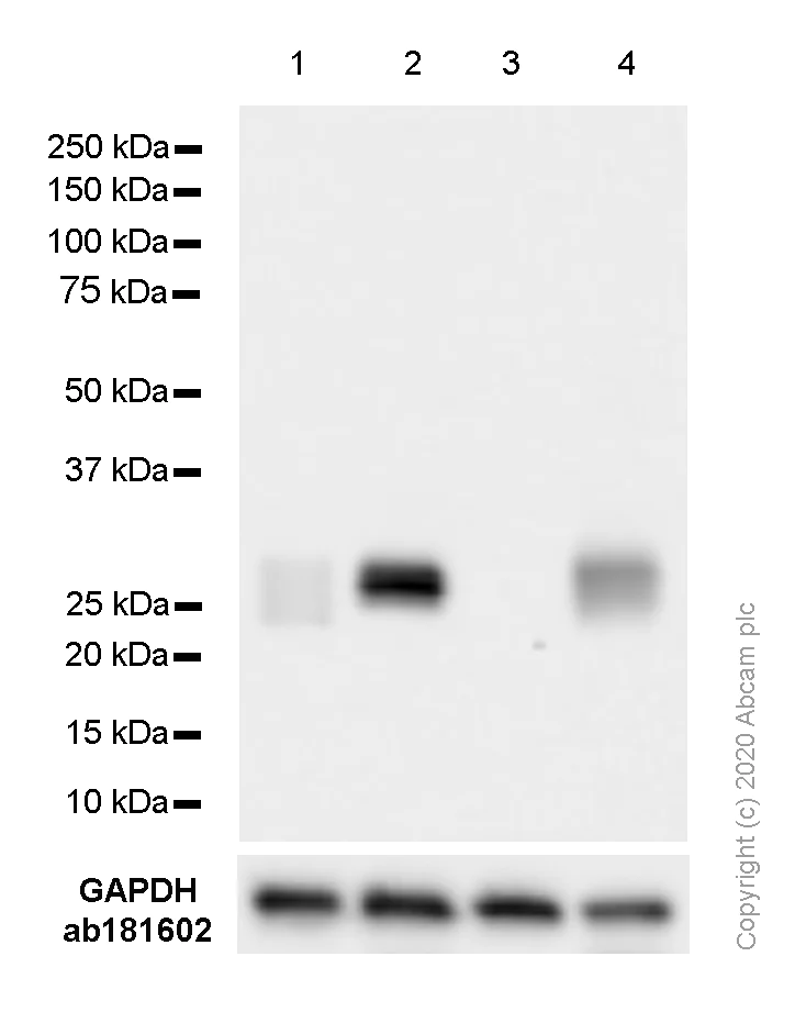 Western blot - Anti-HLA-DPB1 antibody [SP229] (AB227676)