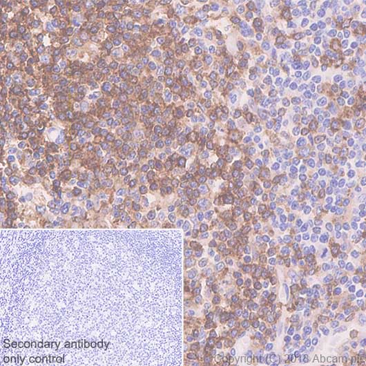 Immunohistochemistry (Formalin/PFA-fixed paraffin-embedded sections) - Anti-HLA-DPB1 antibody [SP229] - BSA and Azide free (AB246351)
