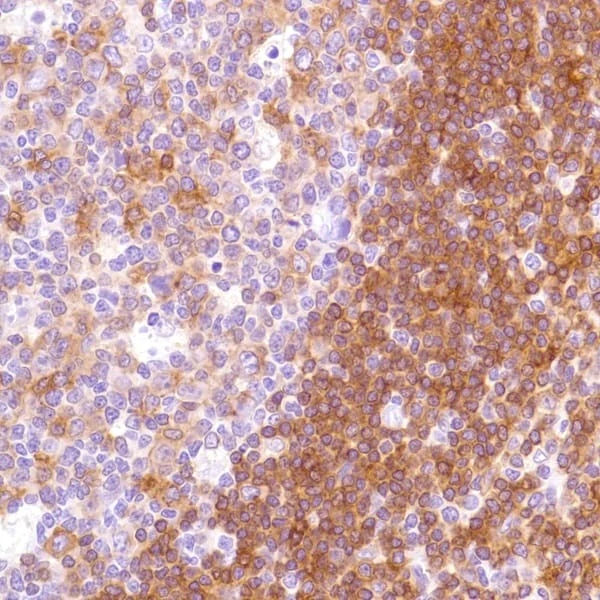 Immunohistochemistry (Formalin/PFA-fixed paraffin-embedded sections) - Anti-HLA-DPB1 antibody [SP229] - BSA and Azide free (AB246351)