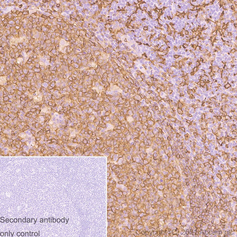 Immunohistochemistry (Formalin/PFA-fixed paraffin-embedded sections) - Anti-HLA-DQA1 antibody [EPR7300] (AB128959)