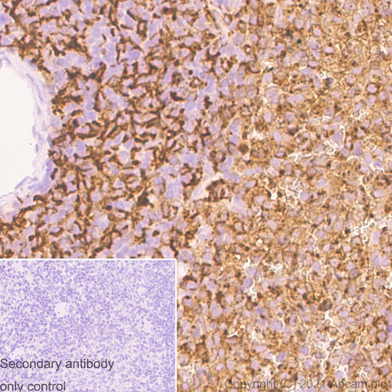 Immunohistochemistry (Formalin/PFA-fixed paraffin-embedded sections) - Anti-HLA-DQA1 antibody [EPR7300] (AB128959)