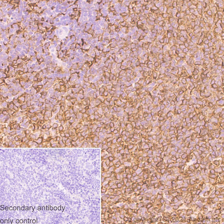 Immunohistochemistry (Formalin/PFA-fixed paraffin-embedded sections) - Anti-HLA-DQA1 antibody [EPR7300] - BSA and Azide free (AB211930)
