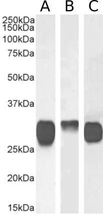 Western blot - Anti-HLA DQA2 antibody [F3.3] (AB288433)
