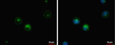 Immunocytochemistry/ Immunofluorescence - Anti-HLA-DQB1 antibody (AB183898), expandable thumbnail