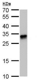 Western blot - Anti-HLA-DQB1 antibody (AB183898), expandable thumbnail