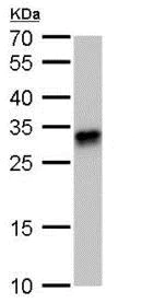 Western blot - Anti-HLA-DQB1 antibody (AB183898)