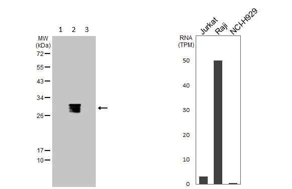 Western blot - Anti-HLA-DQB1 antibody (AB183898)
