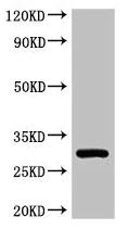 Western blot - Anti-HLA-DQB1 antibody (AB224600)