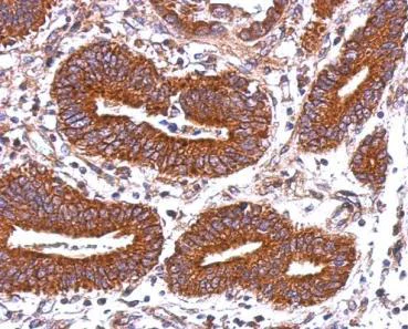 Immunohistochemistry (Formalin/PFA-fixed paraffin-embedded sections) - Anti-HLA-DQB2 antibody (AB126139)