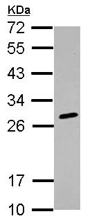 Western blot - Anti-HLA-DQB2 antibody (AB126139)