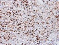 Immunohistochemistry (Formalin/PFA-fixed paraffin-embedded sections) - Anti-HLA-DR antibody (AB137832)
