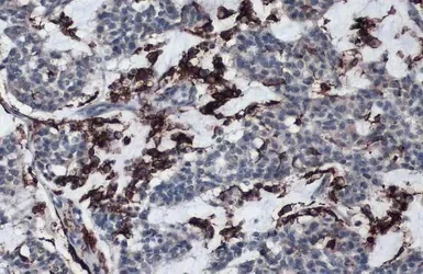 Immunohistochemistry (Formalin/PFA-fixed paraffin-embedded sections) - Anti-HLA-DR antibody (AB137832)