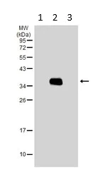 Western blot - Anti-HLA-DR antibody (AB137832)