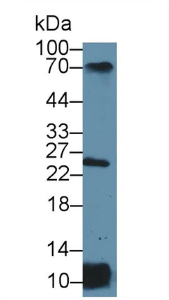 Western blot - Anti-HLA-DR antibody (AB233192)