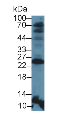 Western blot - Anti-HLA-DR antibody (AB233192)