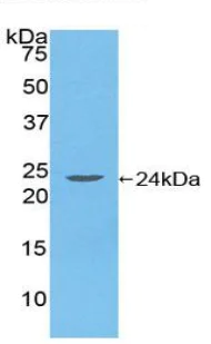 Western blot - Anti-HLA-DR antibody (AB233192)