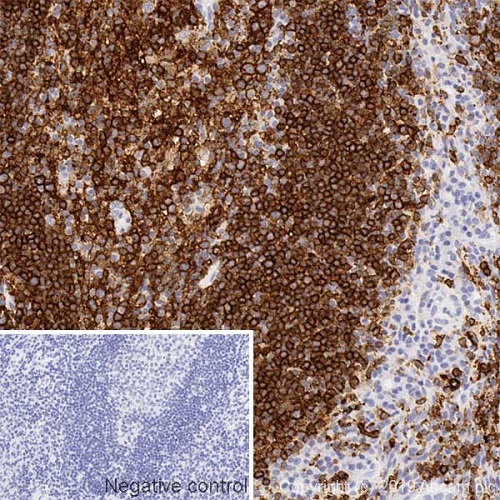 Immunohistochemistry (Formalin/PFA-fixed paraffin-embedded sections) - Anti-HLA-DR antibody [DA6.147] (AB238469), expandable thumbnail