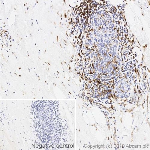 Immunohistochemistry (Formalin/PFA-fixed paraffin-embedded sections) - Anti-HLA-DR antibody [DA6.147] (AB238469), expandable thumbnail