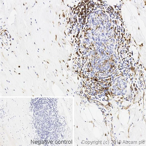 Immunohistochemistry (Formalin/PFA-fixed paraffin-embedded sections) - Anti-HLA-DR antibody [DA6.147] (AB238469)