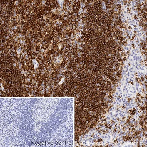 Immunohistochemistry (Formalin/PFA-fixed paraffin-embedded sections) - Anti-HLA-DR antibody [DA6.147] - BSA and Azide free (AB244584)