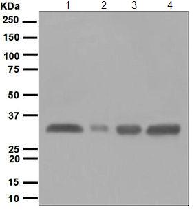 Western blot - Anti-HLA-DR antibody [EPR3691(2)] (AB124809), expandable thumbnail