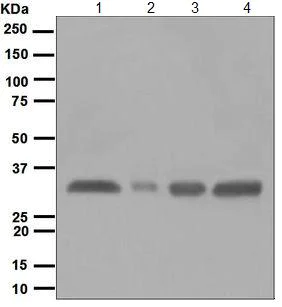 Western blot - Anti-HLA-DR antibody [EPR3691(2)] (AB124809)