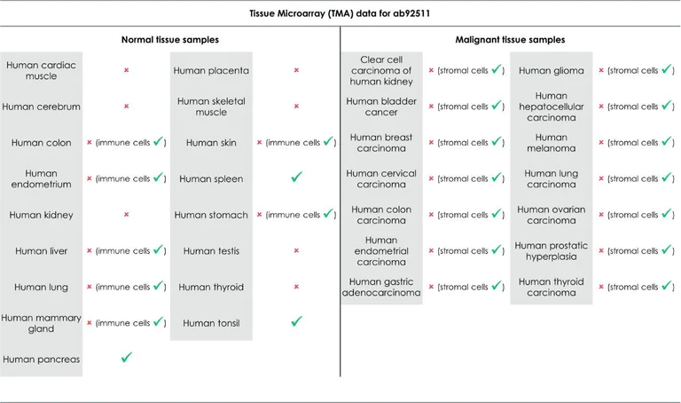 Immunohistochemistry (Formalin/PFA-fixed paraffin-embedded sections) - Anti-HLA-DR antibody [EPR3692] (AB92511)