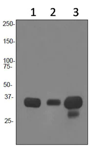 Western blot - Anti-HLA-DR antibody [EPR3692] (AB92511)