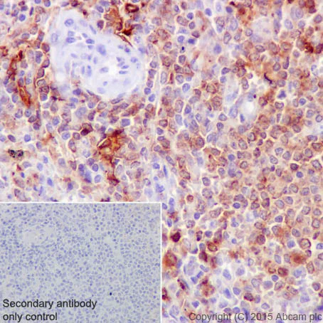 Immunohistochemistry (Formalin/PFA-fixed paraffin-embedded sections) - Anti-HLA-DR antibody [EPR3692] - BSA and Azide free (AB209968)