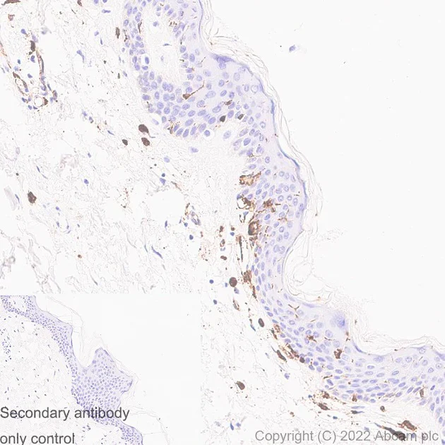 Immunohistochemistry (Formalin/PFA-fixed paraffin-embedded sections) - Anti-HLA-DR antibody [EPR3692] - BSA and Azide free (AB209968)